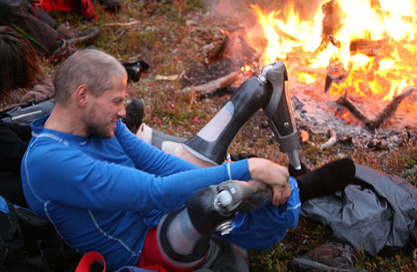 Mens andre skifter sokker, skifter Geir Arne ut beina sine