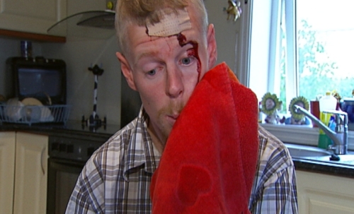 Øyvind Heian fikk en gjenstand i hodet under en skoledebatt i Tønsberg. (Foto: John-Andrè Samuelsen)